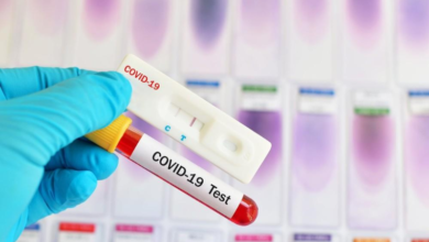 Photo of КДЛ “Олимп” проводит бесплатное тестирование на коронавирус в Кокшетау
