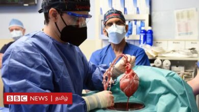 Photo of Сын пациента, которому пересадили свиное сердце, назвал операцию чудом